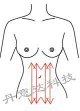 纤体总管:爆脂仪:美体仪器:减肥仪器:减肥设备