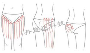 纤体总管:爆脂仪:美体仪器:减肥仪器:减肥设备