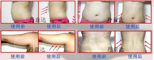纤体总管:爆脂仪:美体仪器:减肥仪器:减肥设备