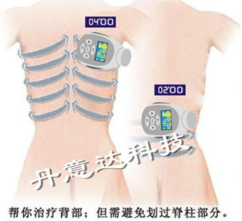 减肥仪器:减肥设备:美体设备